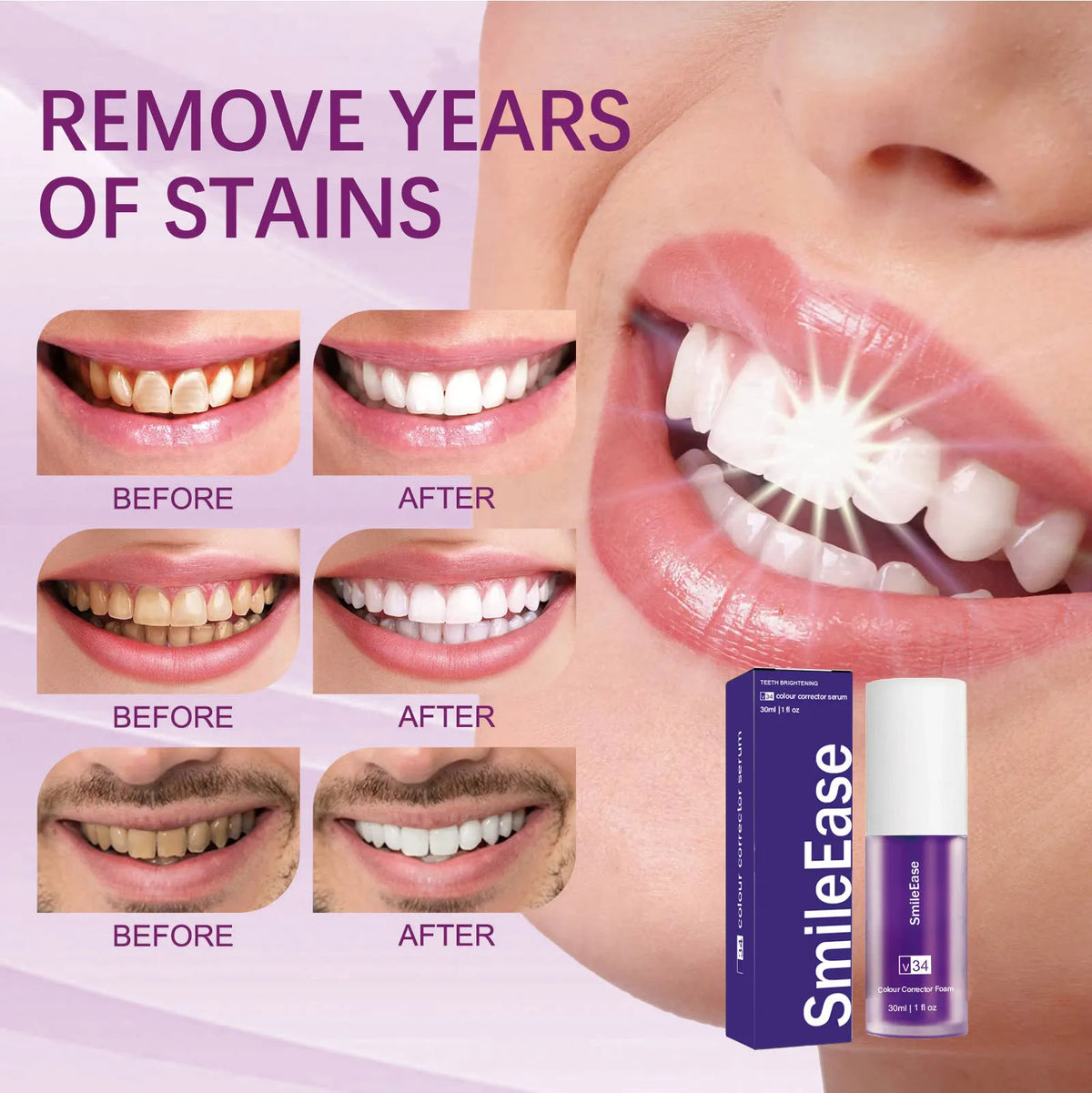 Purple Teeth Whitening Toothpaste – Color Correcting Smile Brightener